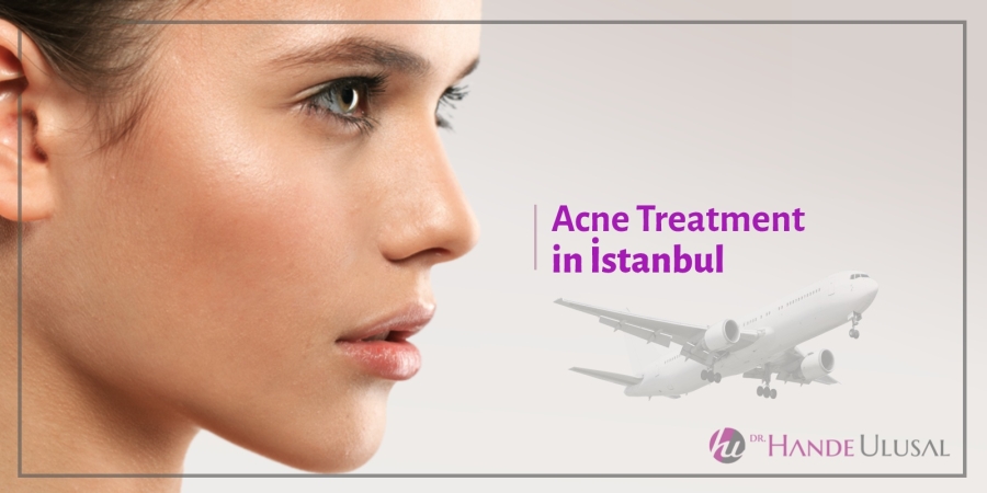 Acne Treatment in İstanbul