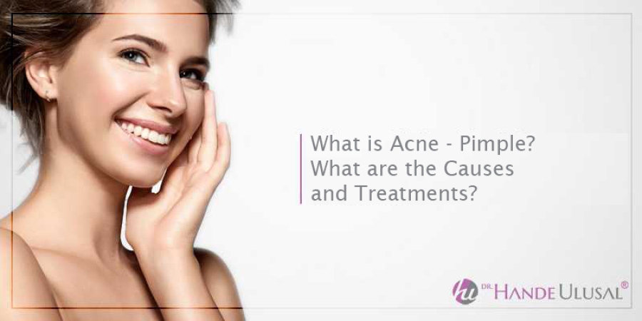 How is Acne (Acne) Treated?