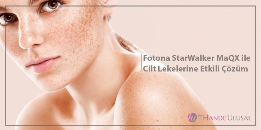 Fotona StarWalker MaQX ile Cilt Lekelerine Etkili Çözüm