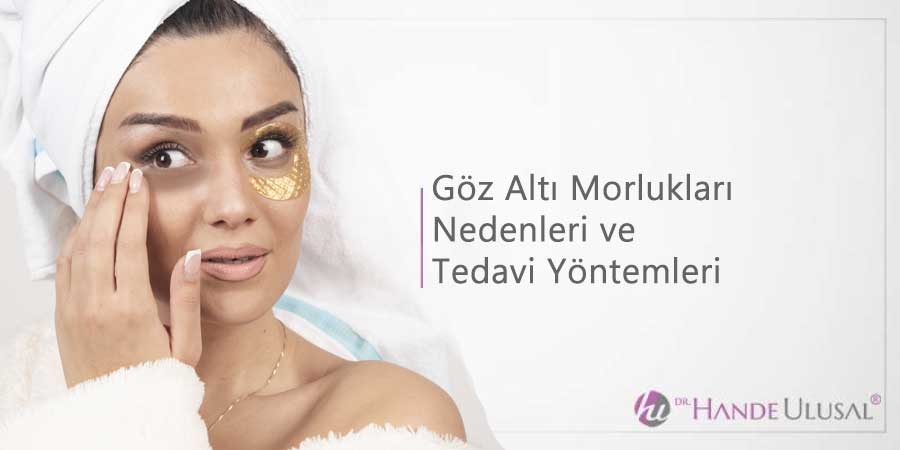 Göz Altı Morlukları Nedenleri Ve Tedavisi