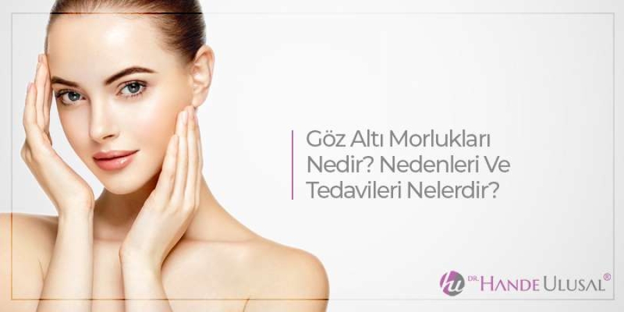 Göz Altı Morluğu Neden Oluşur? Tedavi Seçenekleri Nelerdir ?