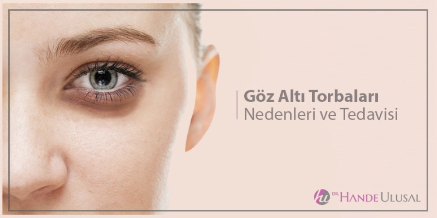 Göz Altı Torbaları