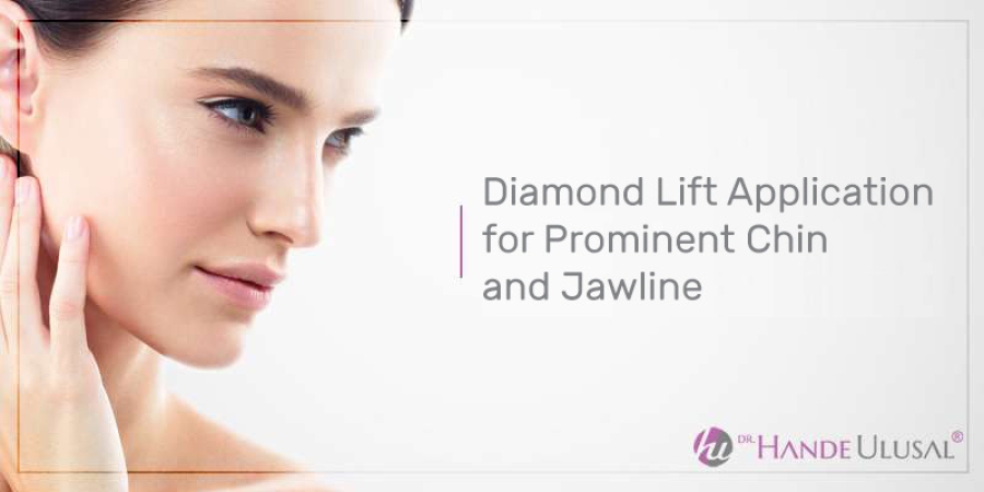 Diamond Lift Application for Prominent Chin and Jawline