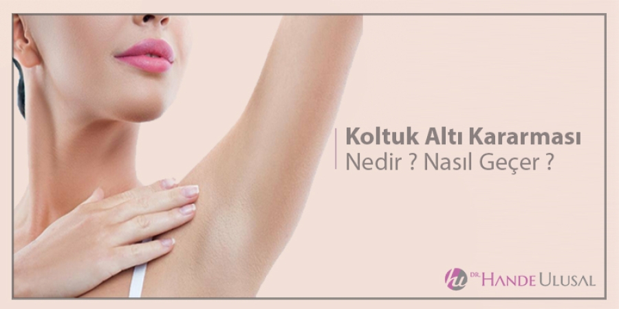 Koltuk Altı Kararması Nedir ? Nasıl Geçer ?