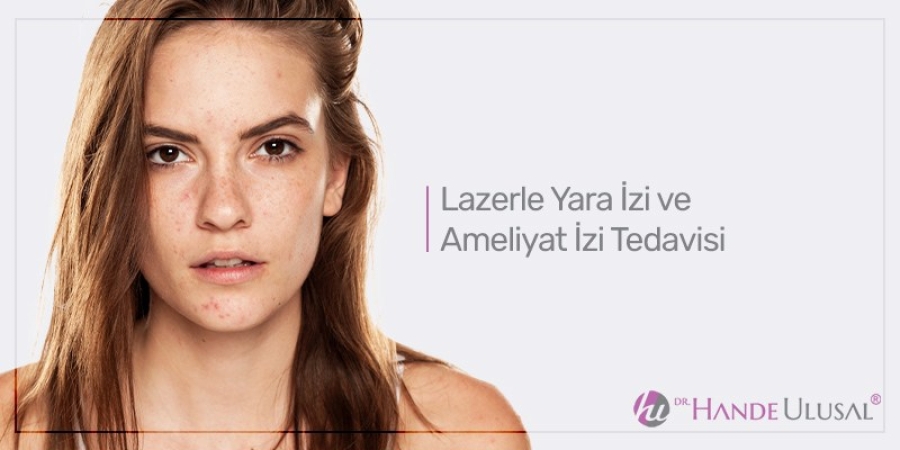 Lazerle Yara İzi Ve Ameliyat İzi Tedavisi