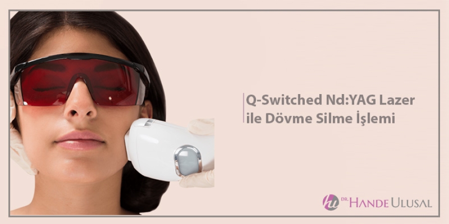 Q-Switched Nd:YAG Lazer ile Dövme Silme İşlemi