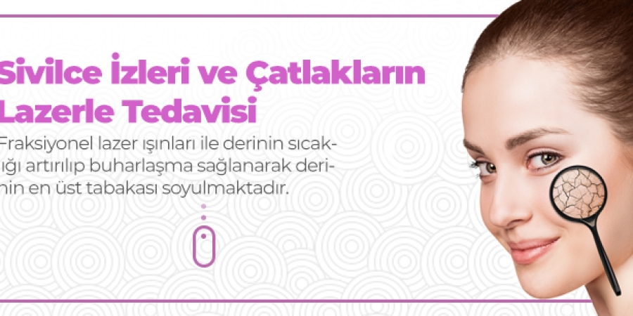 Soluzione alle macchie dell'acne