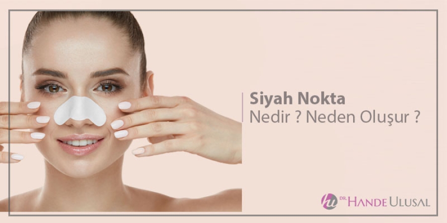 Siyah Nokta Nedir ? Neden Oluşur ? Siyah Nokta Nedir ? Neden Oluşur ?